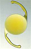 單焦點非球面黃色軟式人工水晶體